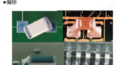 What are the reasons for component displacement in SMT assembly?